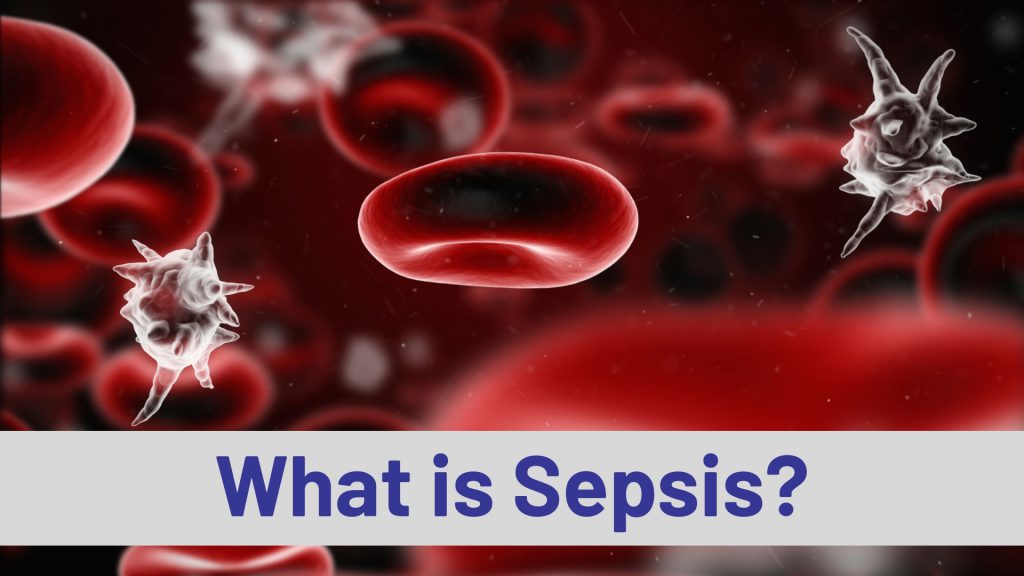 Resources - End Sepsis